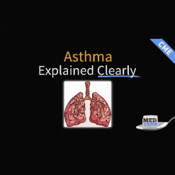 Asthma Explained Clearly