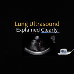 Lung Ultrasound Explained Clearly - Medcram