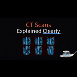 COVID-19 Ventilator Course: Learn or Review Mechanical Ventilation - Medcram