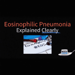 Eosinophilic Pneumonia Explained Clearly - Medcram