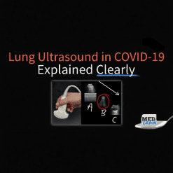 Lung Ultrasound in COVID-19 - Medcram