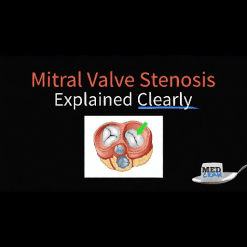 Mitral Valve Stenosis Explained Clearly - Medcram