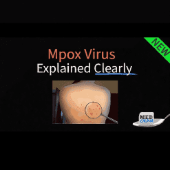 Mpox Explained Clearly - Medcram