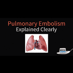 Pulmonary Embolism Explained Clearly - Medcram