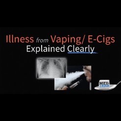 Vaping Associated Lung Injury Explained Clearly