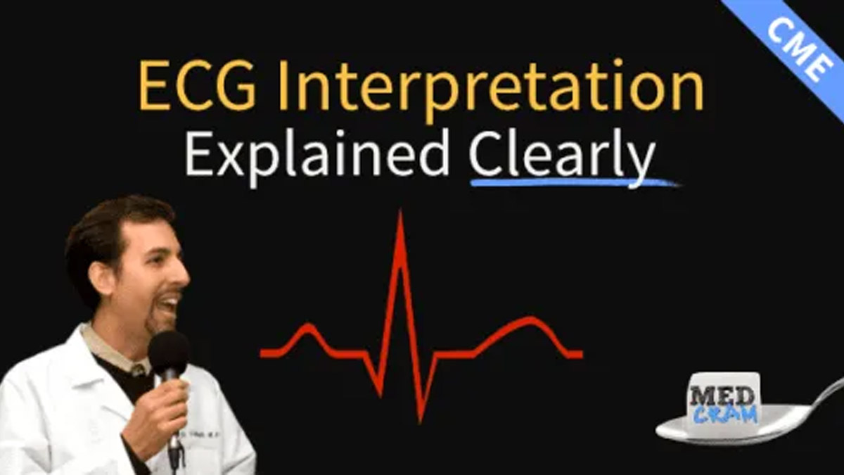 Mastering ECGEKG Interpretation Your Guide to Clear Understanding