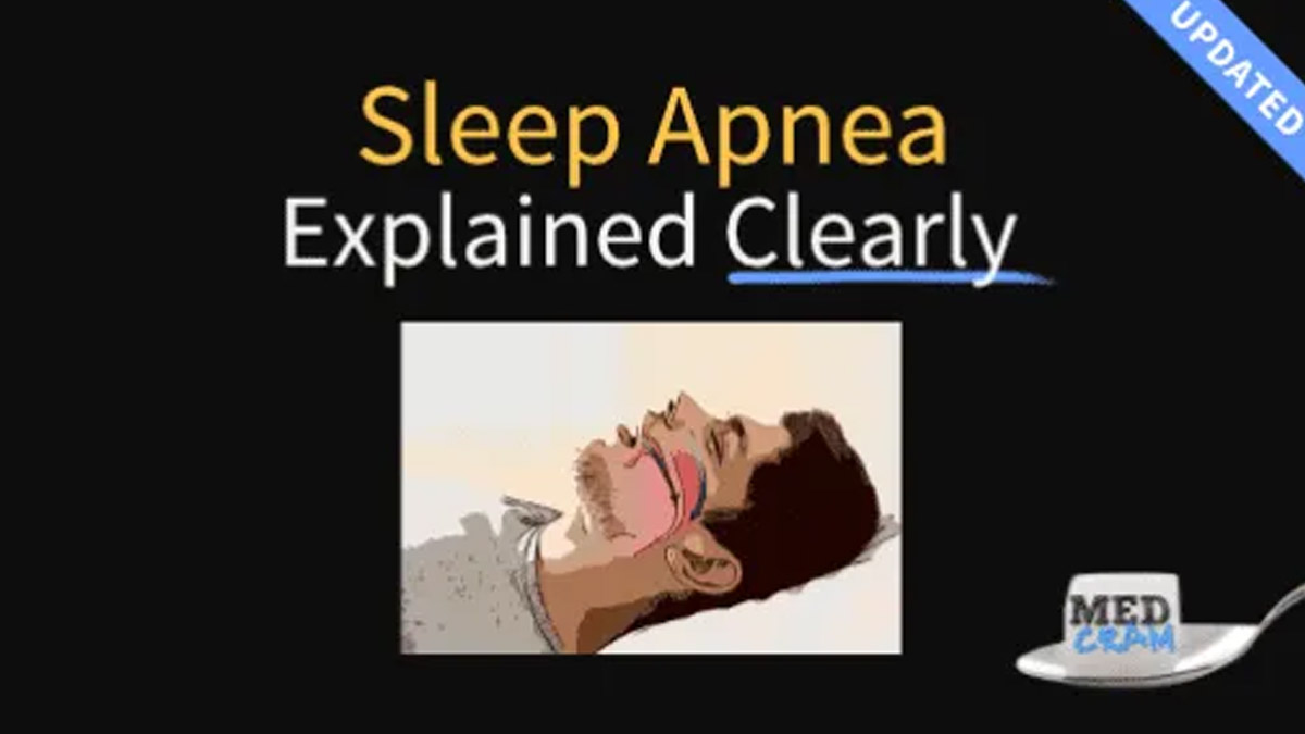 Understanding Sleep Apnea A Comprehensive Guide