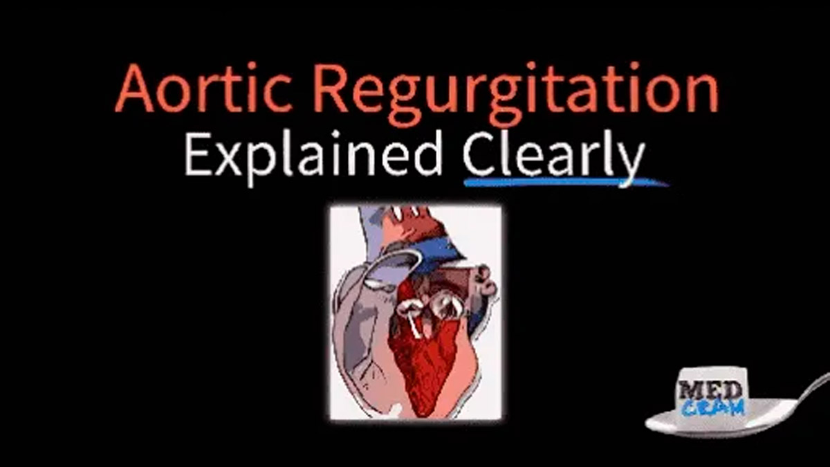 Aortic Regurgitation Explained
