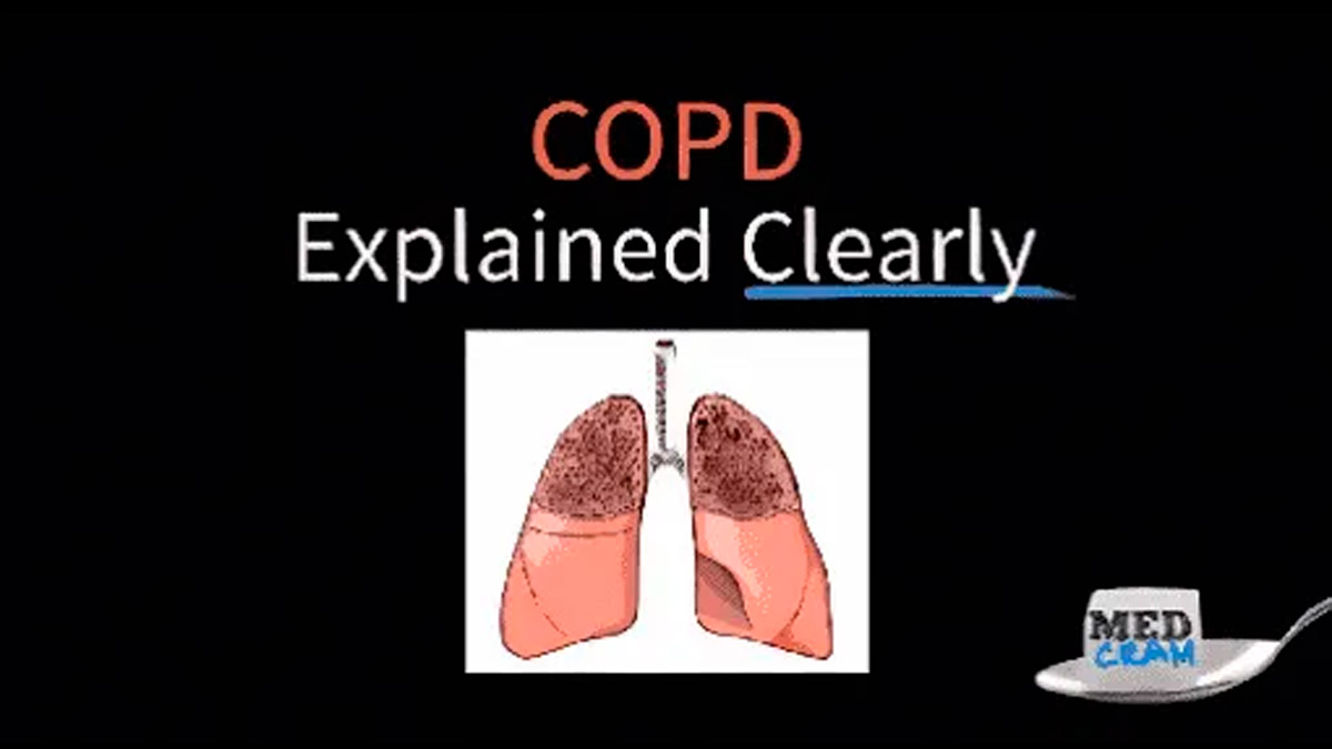 Comprehensive Overview of COPD and Emphysema: Explained Clearly
