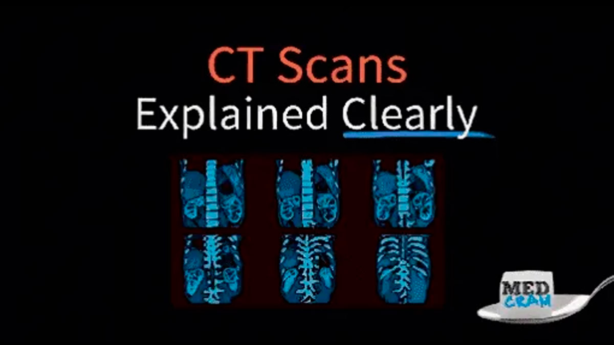 Understanding CT vs. High-Resolution CT Scan (HRCT)