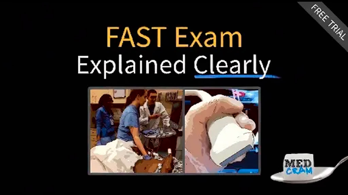 E-FAST Exam: A Comprehensive Guide
