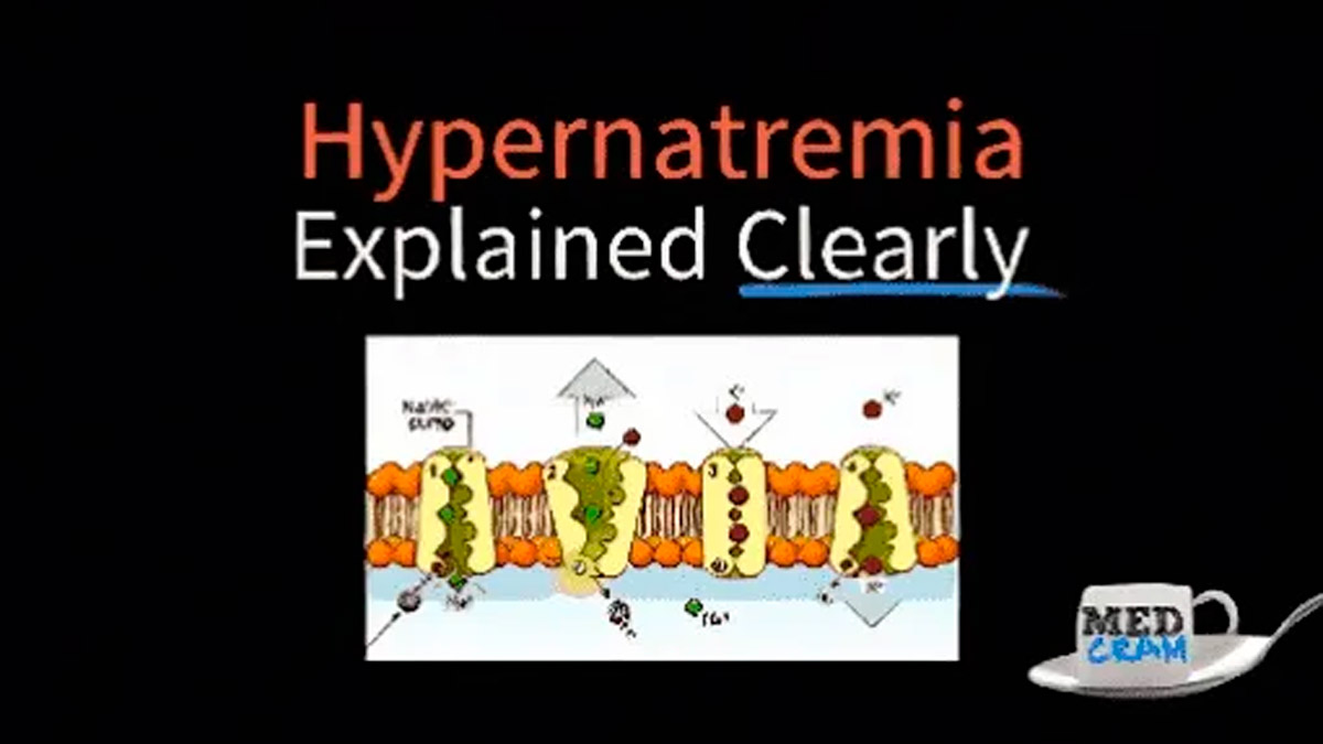 Understanding Hypernatremia A Clear Explanation
