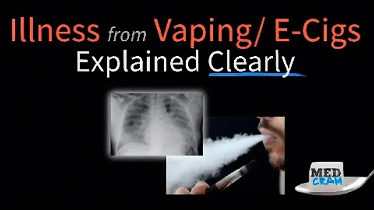 Vaping-Associated Lung Injury (EVALI) — Explained Clearly