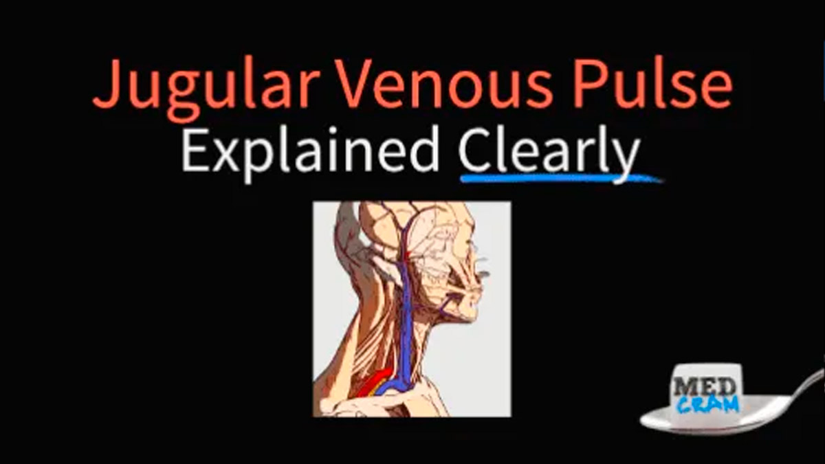 Jugular Venous Pulse (JVP) Explained Clearly - MedCram