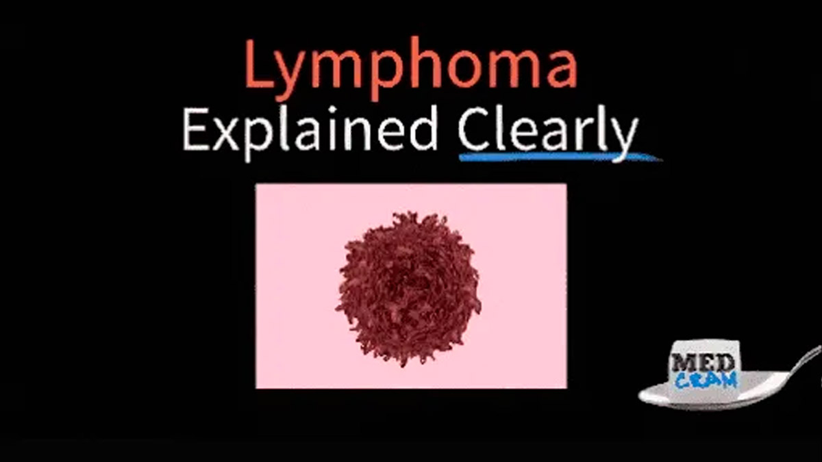 Understanding Lymphoma A Comprehensive Course by MedCram